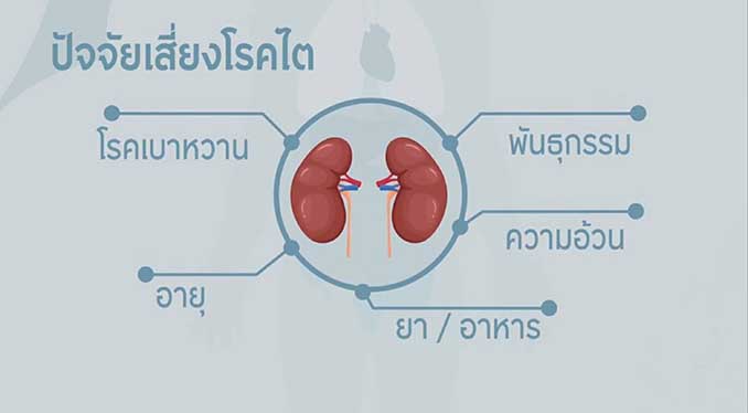 สมาคมเพื่อนโรคไตแห่งประเทศไทย ชวนชมเรื่องจริงจากผู้ป่วย “โรคไตเรื้อรัง